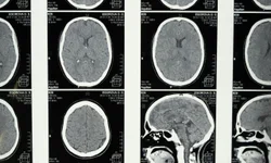 Unipampa promove simpósio sobre neurociência e sistema nervoso