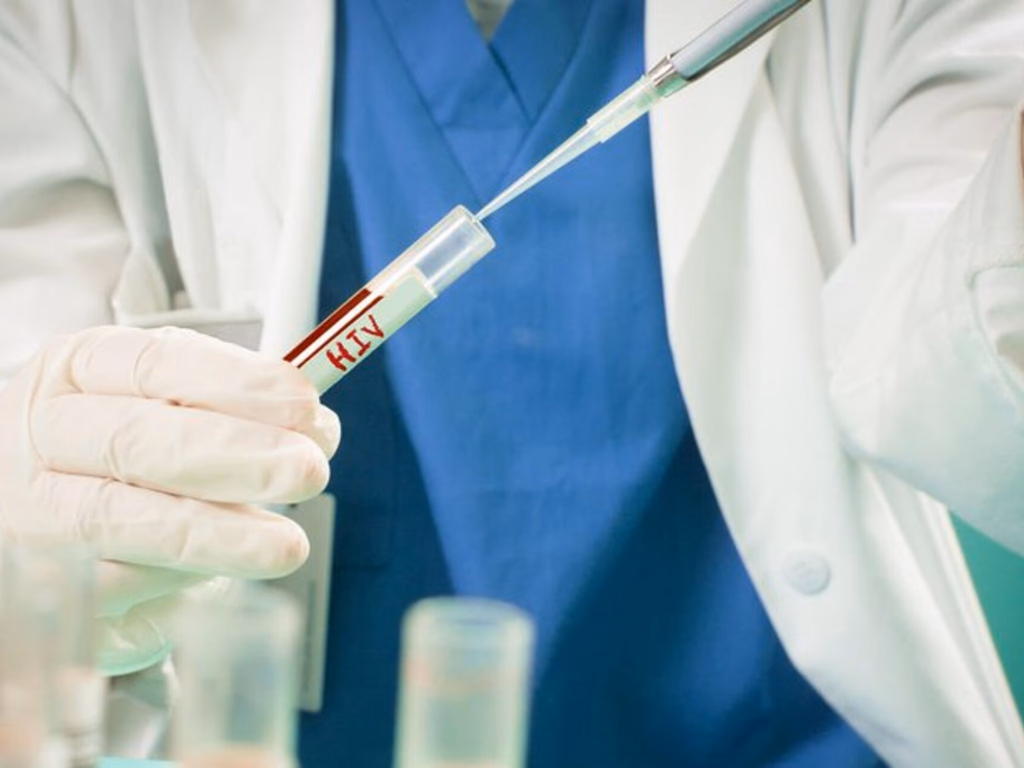 Estudo aponta paciente com HIV curado após transplante de células-tronco