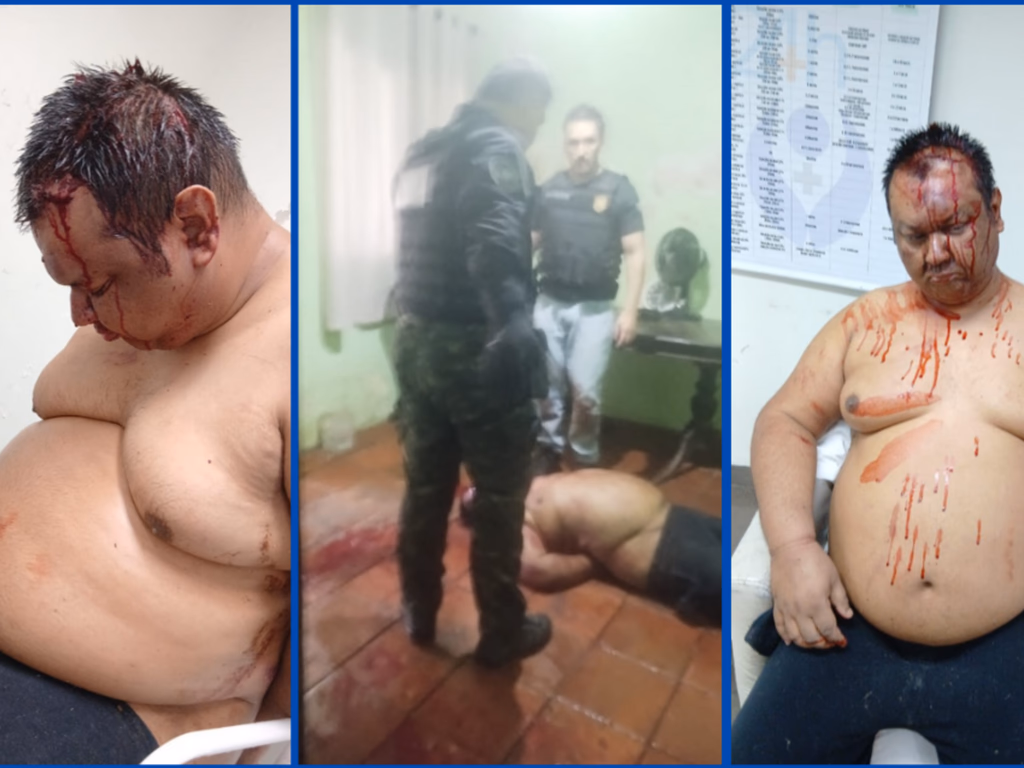 Polícia Civil espanca homem com esquizofrenia