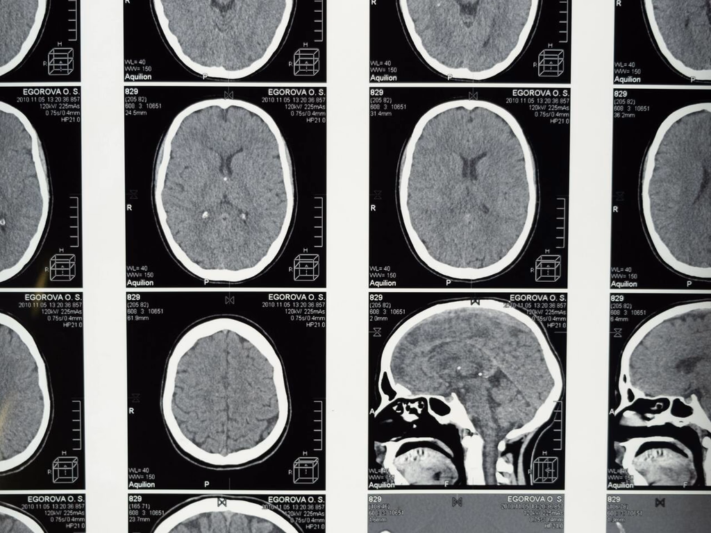 Unipampa promove simpósio sobre neurociência e sistema nervoso