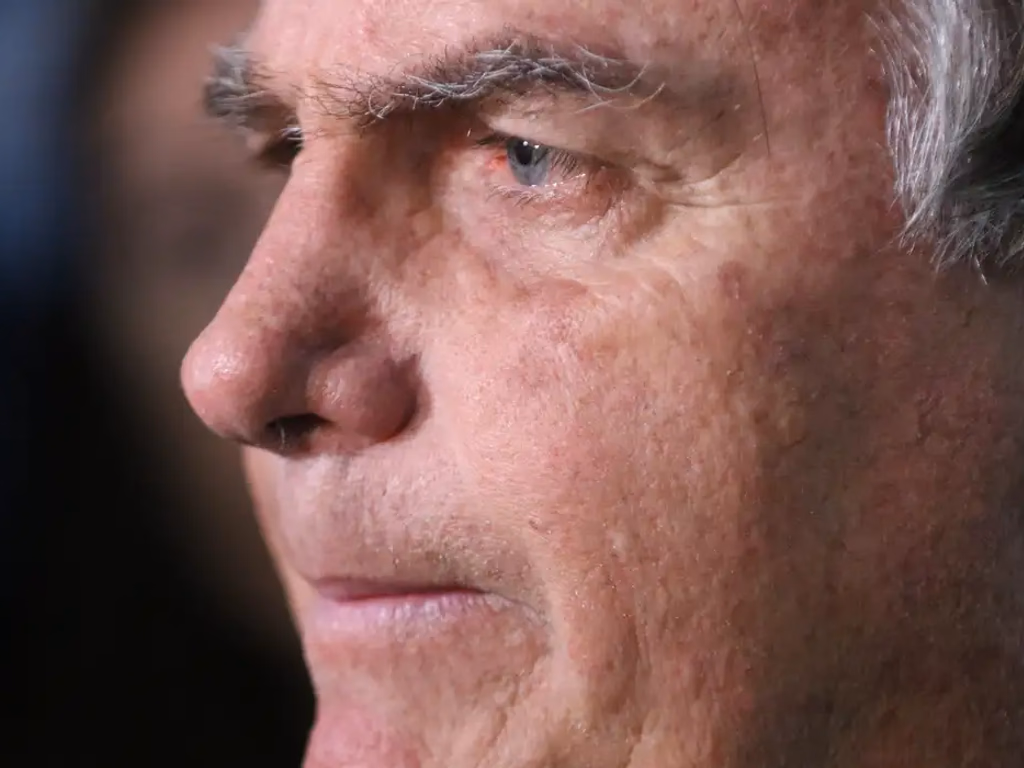 Com crise persistente de soluços, Bolsonaro faz nova cirurgia