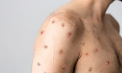 PC encontra 18 menores tidos como desaparecidos