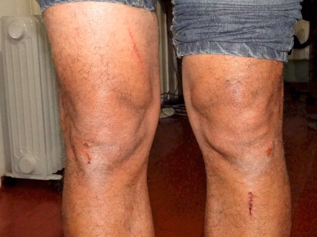 PMs e tenente do EB são indiciados após espancamento de jornalistas