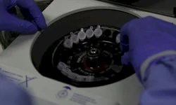 Prefeitura realiza coleta de lixo eletrônico nesta sexta