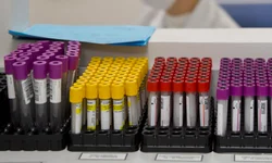 Sintomas de Alzheimer precoce podem surgir a partir dos 30