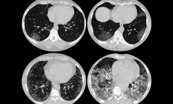 Santa Casa recebe R$ 530 mil do RS