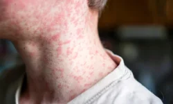 Vacina contra bronquiolite ainda não chegou à rede municipal