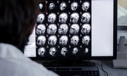 Médico alerta sobre doenças cardiovasculares no inverno