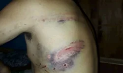 Abordagem policial termina com feridos e 1º BPAF vai apurar