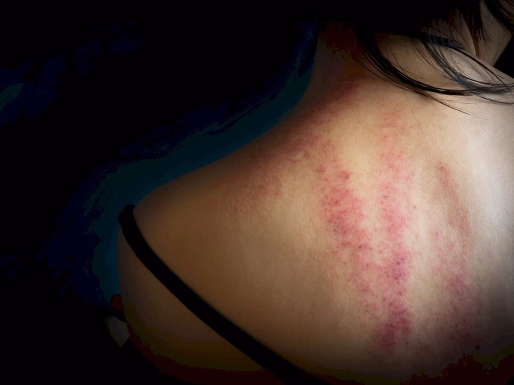 Tentativas de feminicídios aumentam em Uruguaiana