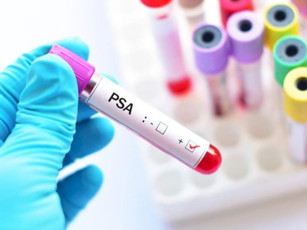 Campanha Novembro Azul registrou mais de 200 atendimentos