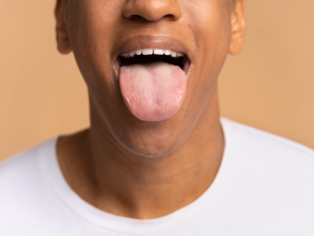 Quais os sintomas e como prevenir