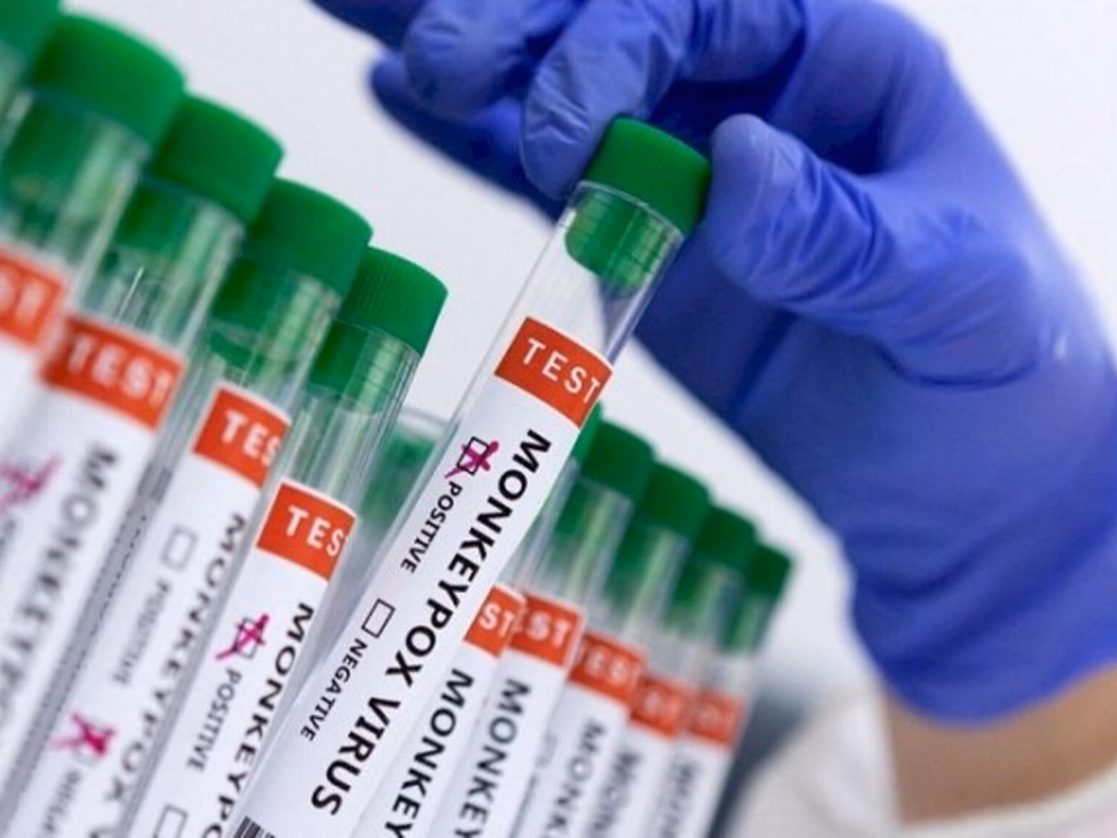 Uruguaiana confirma primeiro caso da varíola dos macacos