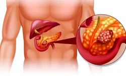 Em um ano, planos de saúde ganham 1,6 milhão de usuários