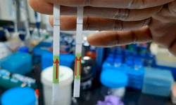 O Municio registrou 26 novos casos confirmados nas últimas 24 horas