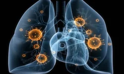 Uruguaiana integrou pesquisa que mapeou a Aids no Estado