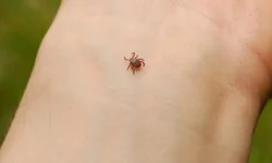 Mortes aumentaram 62% entre mulheres de 15 a 49 anos