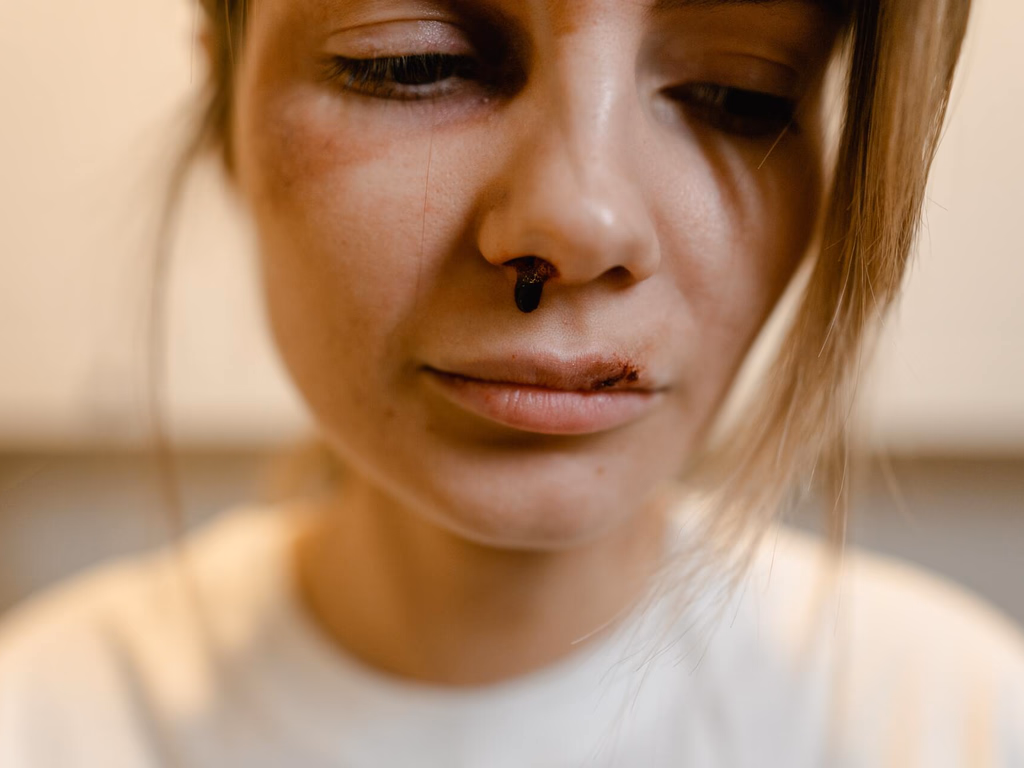 Ocorrências de lesões corporais aumentaram 120% no município