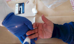 Rompimento de cabo deixa parte da cidade sem energia