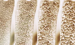 Estado emite Aviso somente para a região Covid de Pelotas