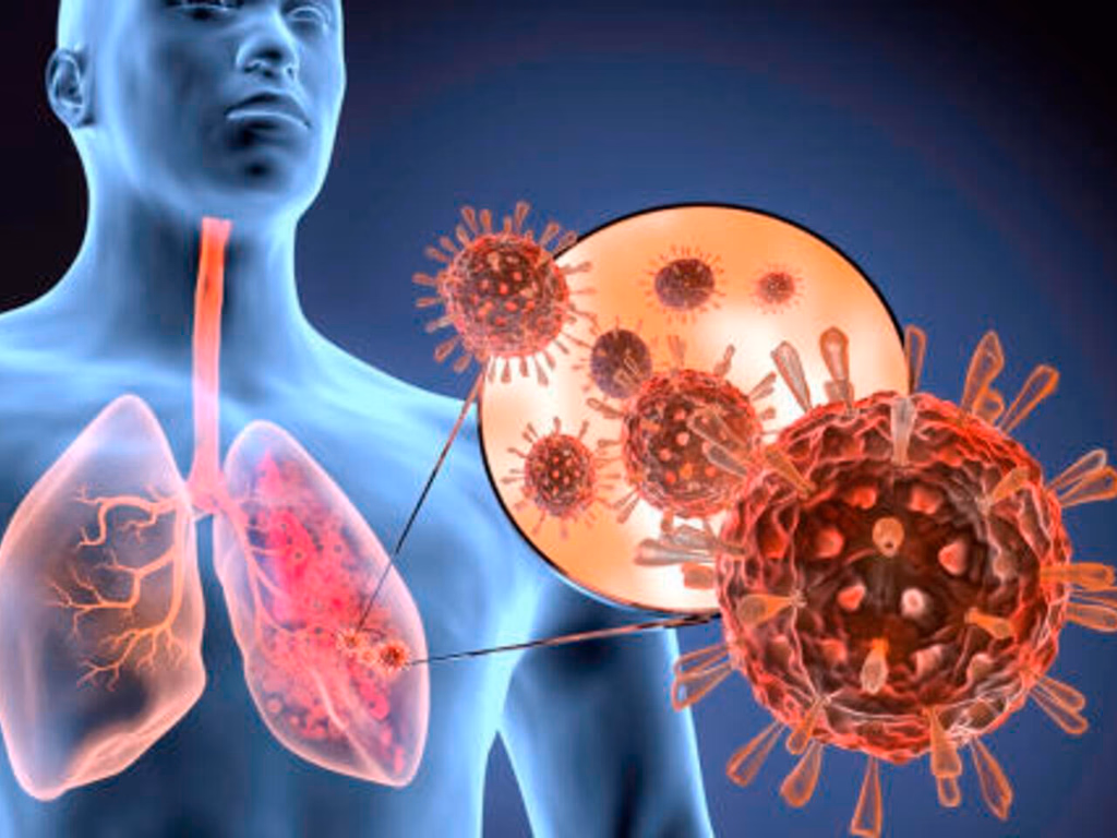 Uruguaiana registra morte por vírus sincicial