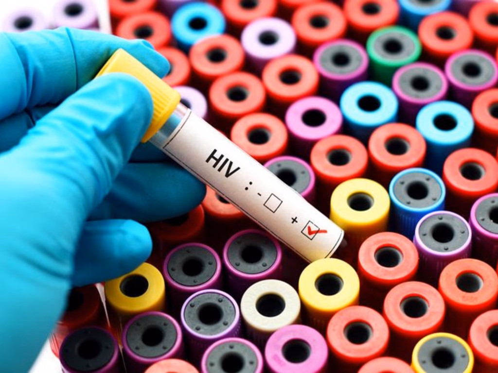 Vacina contra o HIV se mostra ineficaz em testes clínicos