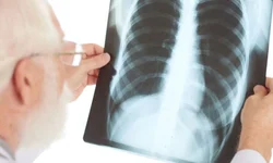 Ministério da Cultura oferece vagas para nível superior