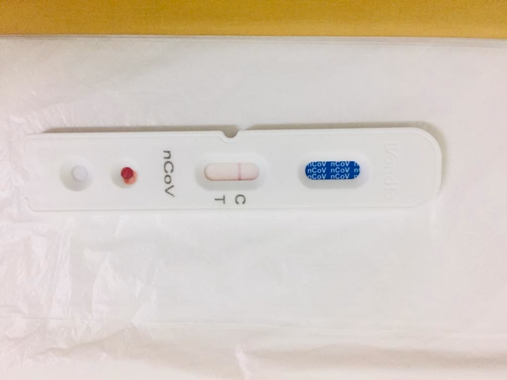 Uruguaiana recebe 160 testes rápidos do Governo do Estado