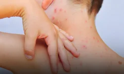 Município aplicou mais de 17 mil vacinas contra a Influenza