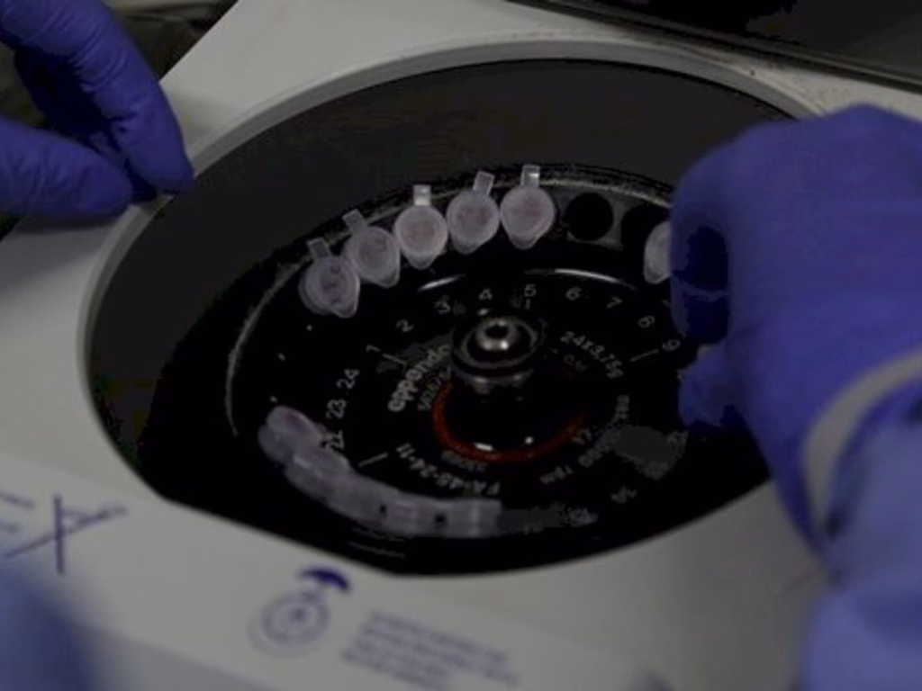 Nova estratégia para monitoramento aumenta número de suspeitas