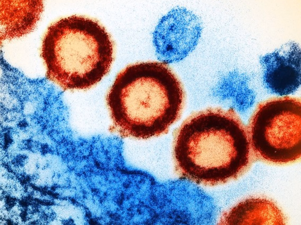 Remédio que previne HIV por um ano deve ficar pronto em 2030