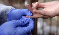 Secretaria promete conserto de Raio X nesta semana