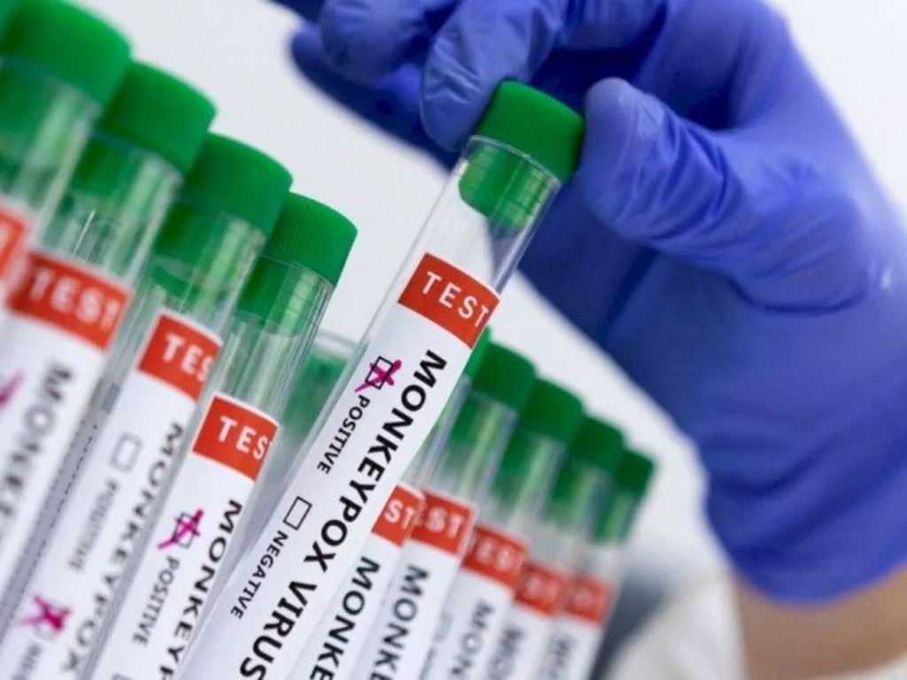 RS confirma primeiro caso de varíola do macaco