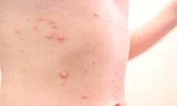 Homenagem a Pepe Mujica é marcada por protesto