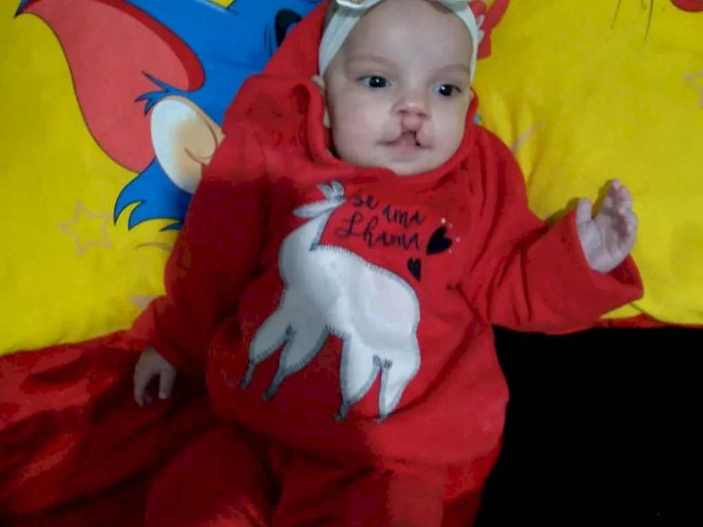 Família busca recursos para bebê fazer cirurgia