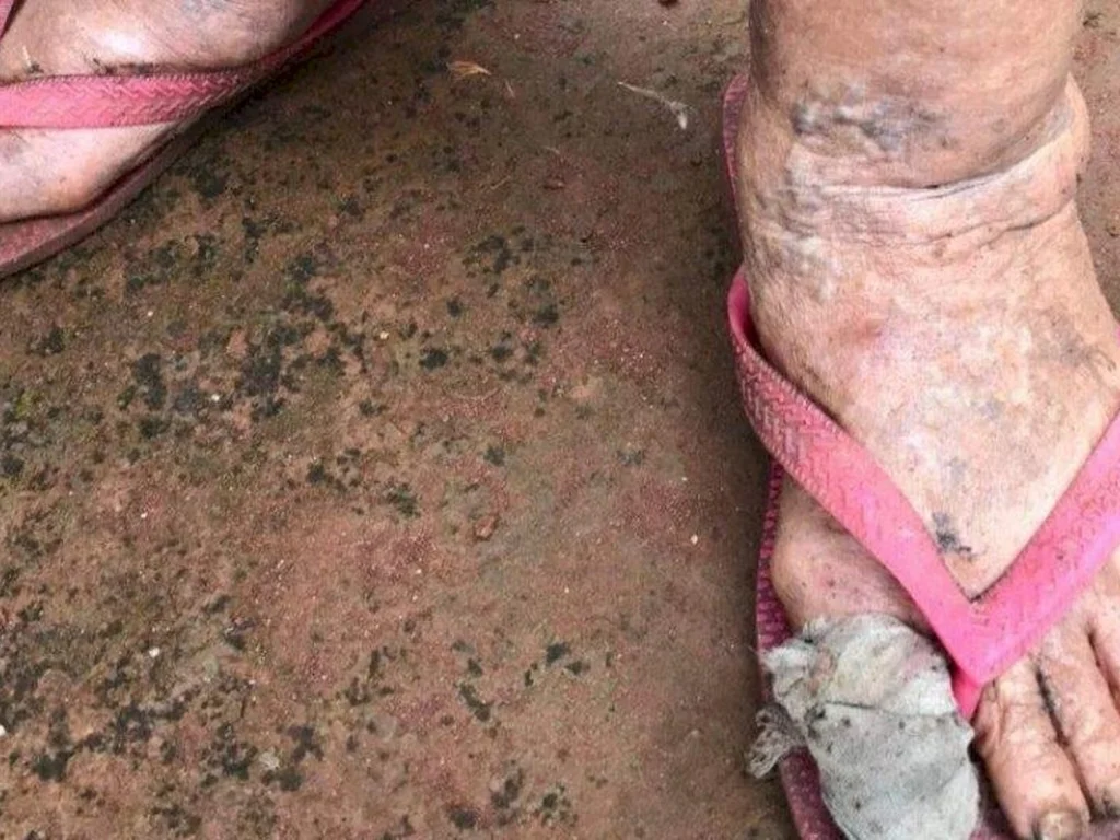 Idosas sofrem violência sexual em Bagé