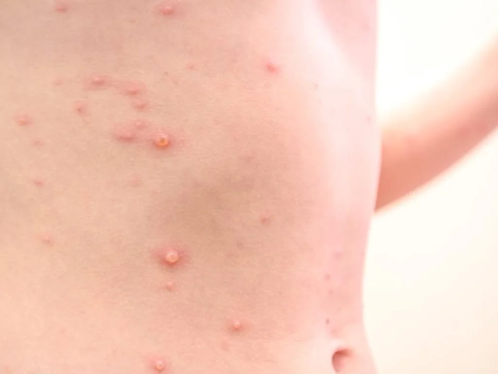 Saúde terá reunião para definir estratégias