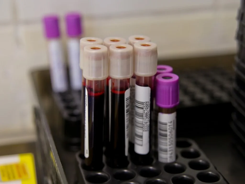 Com estoques baixos, apelo é para que população doe sangue