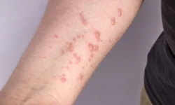 Vacinação ocorre neste sábado no Coreto