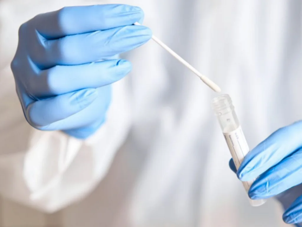 Procura por testes cai para 40 por dia