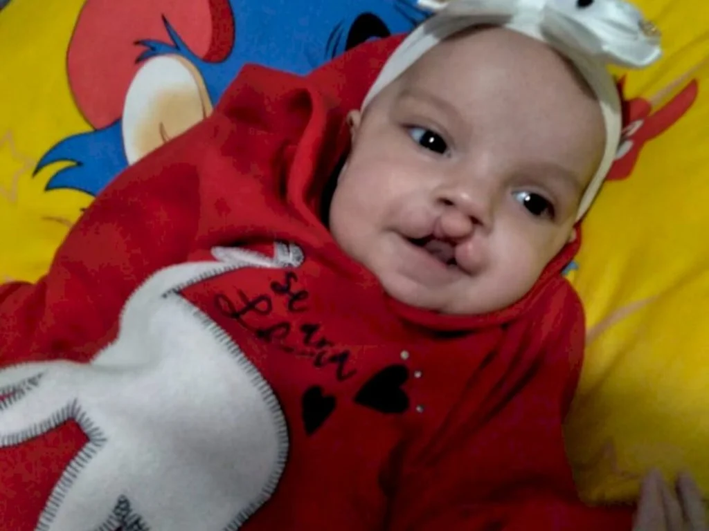 Bageenses atendem apelo em favor de bebê de quatro meses