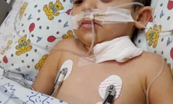 Radioterapia deve começar ainda em outubro