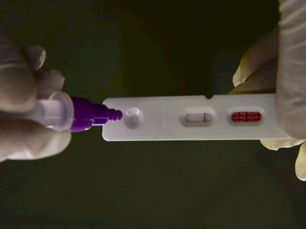 Pesquisadores identificam método capaz de prever gravidade da covid-19