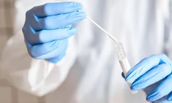 Radioterapia deve começar ainda em outubro